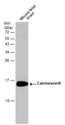 Anti-Calcineurin B antibody used in Western Blot (WB). GTX109127